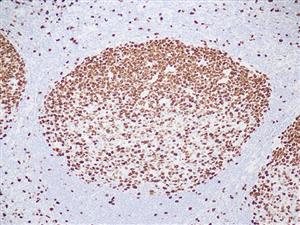 3485A | Control Slides:Immunopathology; Ki-67